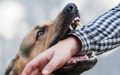 Severe Neighbor’s Dog Bite Attack